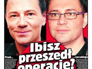 Czy Krzysztof Ibisz zrobił operację twarzy?