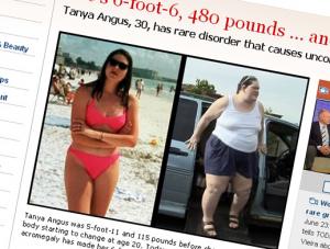 Jej koszmar: 2 metry wzrostu i 215 kilo wagi